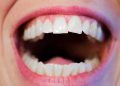 5 мита за здравите зъби